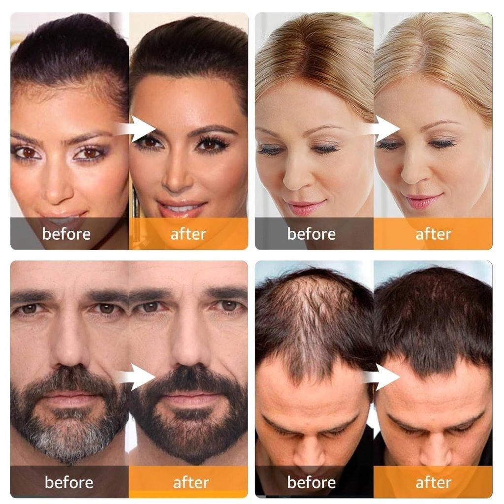 Hairline Black Powder β Portable Hair Filler for Instant Coverage & Thicker Look