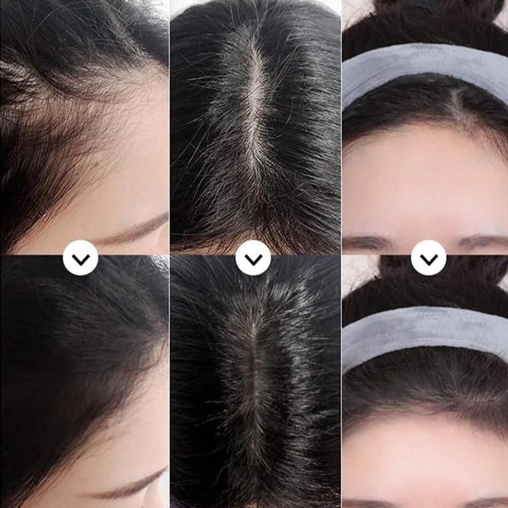 Hairline Black Powder – Portable Hair Filler for Instant Coverage & Thicker Look
